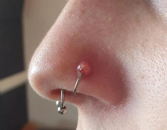 What Are The Common Causes Of A Smelly Nose Piercing