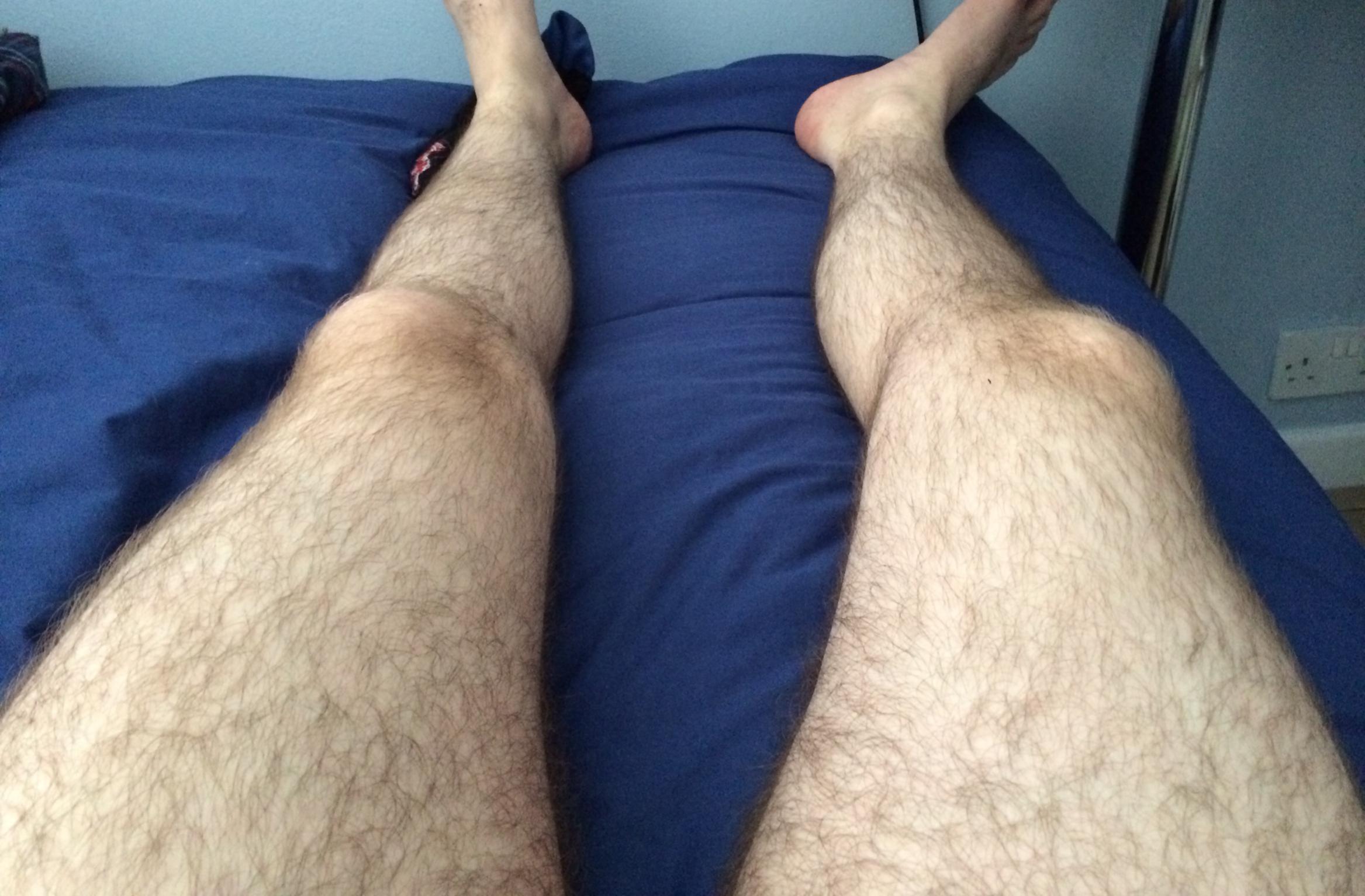 why are my legs so hairy
